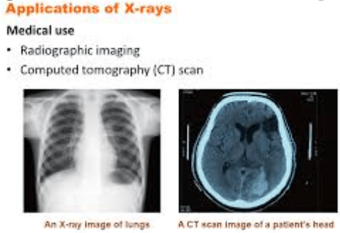 Uses of x Rays